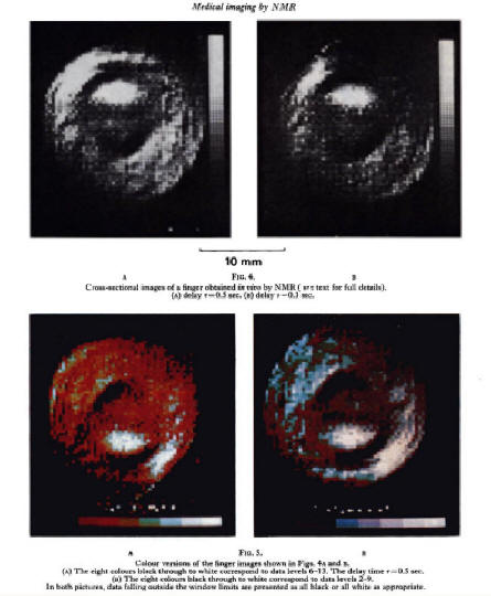 the first MRI scan of a human body part