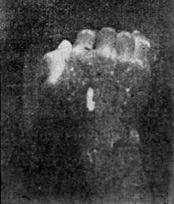 and another of the first 3 photographs by ultra-violet radiation