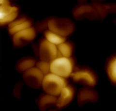 photo of red blood cells recovered from Ötzi the iceman