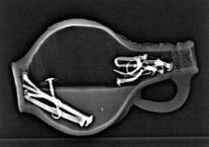 C T scan of a 17th century witch bottle, showing human urine, pins and nails